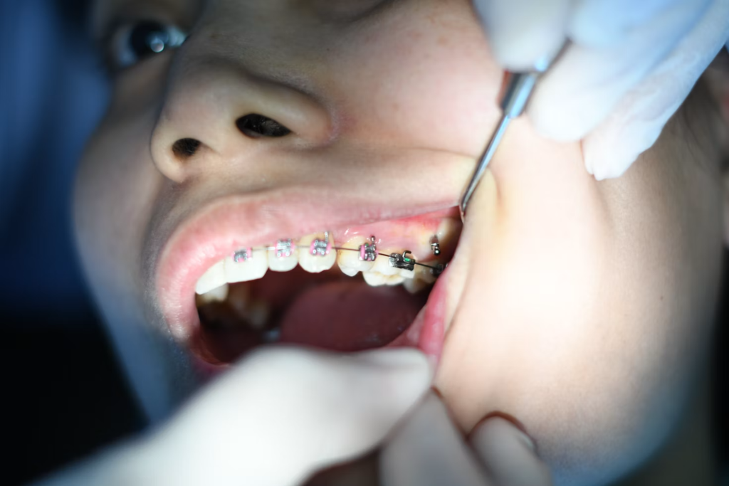 children orthodontist singapore