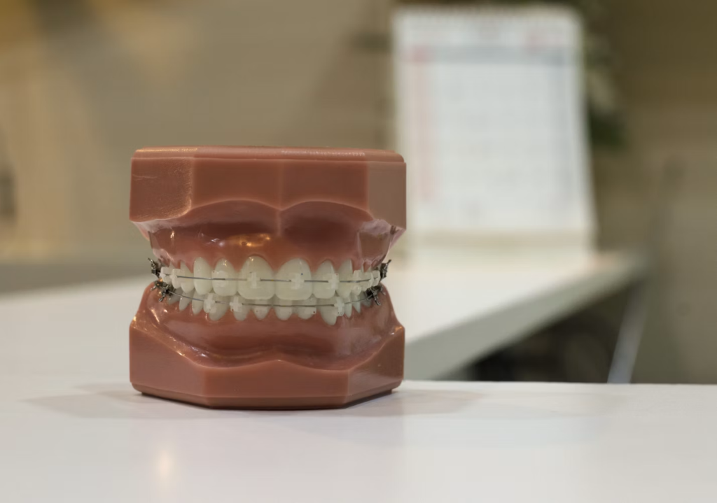 support care orthodontist singapore