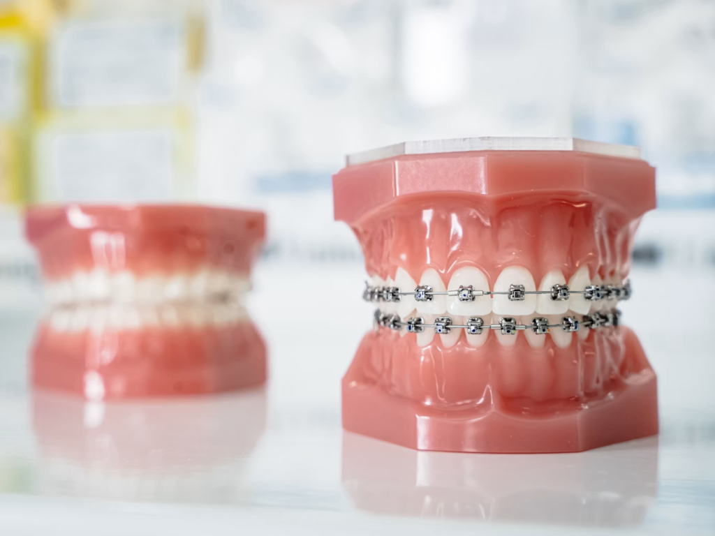what is orthodontist singapore